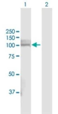 PHEX Antibody, Novus Biologicals 0.1 mg | Buy Online | Novus Biologicals | Fisher Scientific