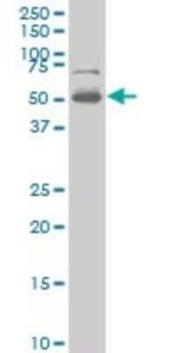 PHF1 Antibody (2A12), Novus Biologicals 0.1 mg | Buy Online | Novus Biologicals | Fisher Scientific