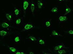 PHF1 Antibody, Novus Biologicals:Anticorps:Anticorps primaires