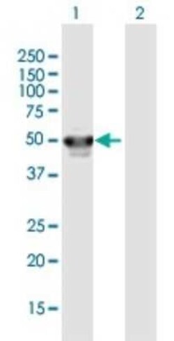 PHF10 Antibody, Novus Biologicals 0.05 mg | Buy Online | Novus Biologicals | Fisher Scientific