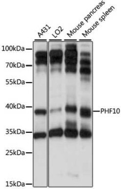 PHF10 Antibody - Azide and BSA Free, Novus Biologicals 0.02 mL; Unconjugated:Antibodies,