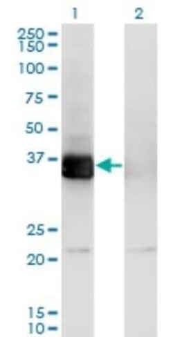 PHF11 Antibody (3B8), Novus Biologicals 0.1 mg | Buy Online | Novus Biologicals | Fisher Scientific