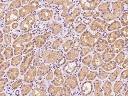 PHF11 Antibody, Novus Biologicals:Antibodies:Primary Antibodies