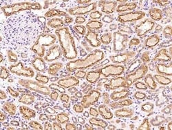PHF13 Antibody, Novus Biologicals 50 &mu;g, Unconjugated:Antibodies, Polyclonal