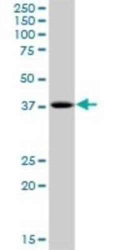 PHF20L1 Antibody, Novus Biologicals 0.05 mg | Buy Online | Novus Biologicals | Fisher Scientific
