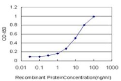 PHF21A Antibody (5A6), Novus Biologicals 0.1 mg | Buy Online | Novus Biologicals | Fisher Scientific