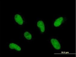 PHF22 Antibody, Novus Biologicals 0.05 mg | Buy Online | Novus Biologicals | Fisher Scientific
