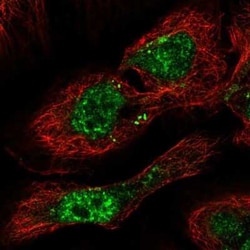 PHF7 Antibody, Novus Biologicals 25 &mu;L, Unconjugated:Antibodies, Polyclonal