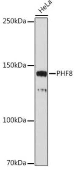 PHF8 Rabbit anti-Human, Mouse, Rat, Clone: 2H9D4, Novus Biologicals 100