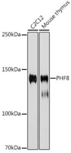 PHF8 Rabbit anti-Human, Mouse, Rat, Clone: 2H9D4, Novus Biologicals 100