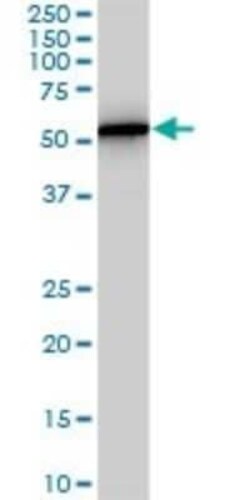 PHGDH Antibody (4A3-1D6), Novus Biologicals 0.1 mg | Buy Online | Novus Biologicals | Fisher Scientific