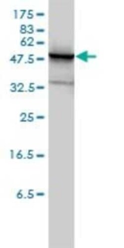 PHGDH Antibody (4A3-1D6), Novus Biologicals 0.1 mg | Buy Online | Novus Biologicals | Fisher Scientific