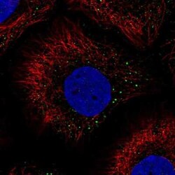 PHGR1 Antibody, Novus Biologicals 25 &mu;L, Unconjugated:Antibodies, Polyclonal