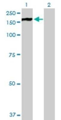 PHKA2 Antibody, Novus Biologicals 0.05 mg | Buy Online | Novus Biologicals | Fisher Scientific
