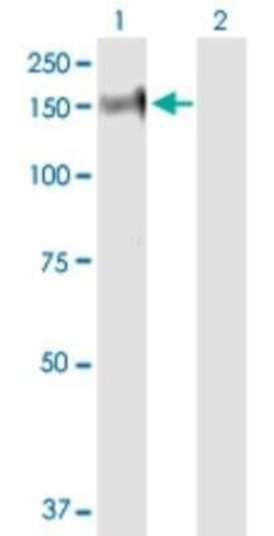 PHKA2 Antibody, Novus Biologicals 0.1 mg | Buy Online | Novus Biologicals | Fisher Scientific