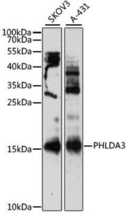PHLDA3 Antibody - Azide and BSA Free, Novus Biologicals 0.02 mL, Unconjugated:Antibodies,