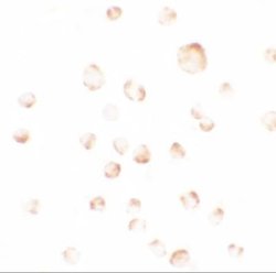 PHLPP Antibody - BSA Free, Novus Biologicals 0.1 mg | Buy Online | Novus Biologicals | Fisher Scientific