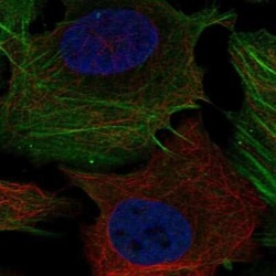 PHOSPHO1 Antibody, Novus Biologicals 25ul; Unconjugated:Antibodies, Polyclonal
