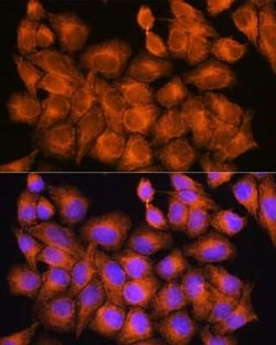 PHOSPHO2 Antibody - Azide and BSA Free, Novus Biologicals:Antibodies:Primary