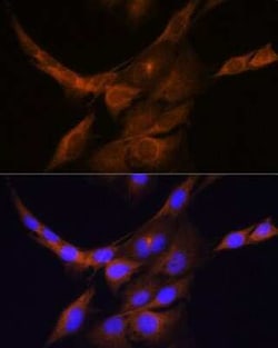 PHOSPHO2 Antibody - Azide and BSA Free, Novus Biologicals:Antibodies:Primary