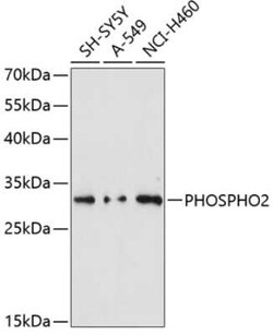 PHOSPHO2 Antibody - Azide and BSA Free, Novus Biologicals:Antibodies:Primary