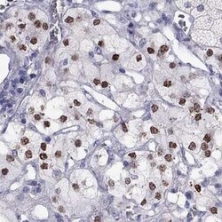 PHOX2A Antibody, Novus Biologicals:Antibodies:Primary Antibodies