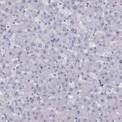 PHOX2A Antibody, Novus Biologicals:Antibodies:Primary Antibodies