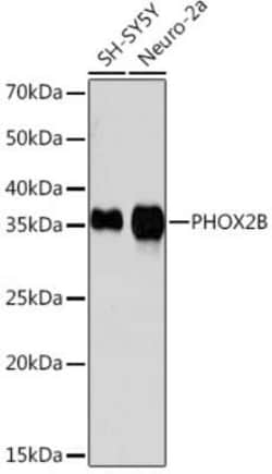 PHOX2B Rabbit anti-Human, Mouse, Clone: 4W5J8, Novus Biologicals 100 &mu;g;
