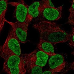 PHOX2B Antibody, Novus Biologicals 25ul; Unconjugated:Antibodies, Polyclonal