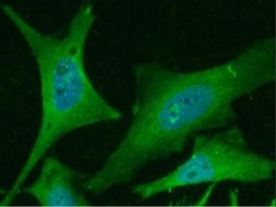 PHPT1 Rabbit anti-Human, Clone: 1, Novus Biologicals 50 &mu;g; Unconjugated:Antibodies,