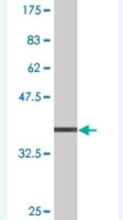 PHTF1 Antibody (3B7), Novus Biologicals 0.1 mg | Buy Online | Novus Biologicals | Fisher Scientific