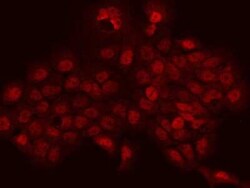 PHTF2 Antibody, Novus Biologicals 100 &mu;g, Unconjugated:Antibodies, Polyclonal