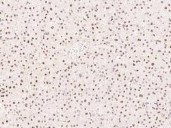 PHTF2 Antibody, Novus Biologicals 100 &mu;g, Unconjugated:Antibodies, Polyclonal
