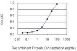 PHYH Antibody (1F2-5B9), Novus Biologicals 0.1 mg | Buy Online | Novus Biologicals | Fisher Scientific