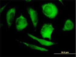 PHYH Antibody, Novus Biologicals 0.05 mg | Buy Online | Novus Biologicals | Fisher Scientific