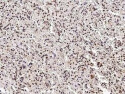 PHYH Antibody, Novus Biologicals 100 &mu;g | Buy Online | Novus Biologicals | Fisher Scientific