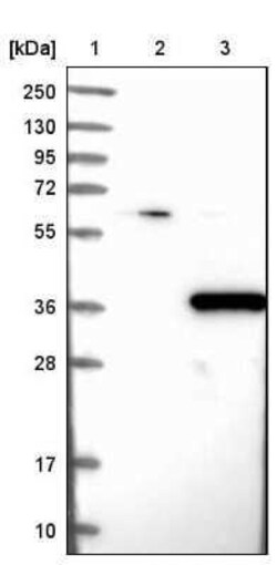 PHYHD1 Antibody, Novus Biologicals 0.1 mL | Buy Online | Novus Biologicals | Fisher Scientific