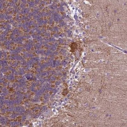 PHYHIP Antibody, Novus Biologicals:Antibodies:Primary Antibodies
