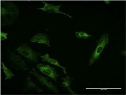 PI 3-Kinase C2 beta Antibody (1H4), Novus Biologicals 100 &mu;g | Buy Online | Novus Biologicals | Fisher Scientific