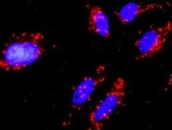 PI 3-Kinase p110 beta/PIK3CB Antibody (10D5), Novus Biologicals 0.1 mg | Buy Online | Novus Biologicals | Fisher Scientific