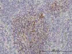 PI 3-Kinase p110 beta/PIK3CB Antibody (4H2), Novus Biologicals 0.1 mg,