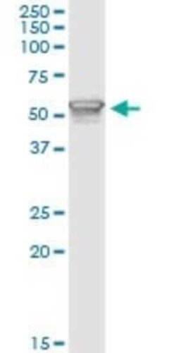 PI 3-Kinase p85 alpha Antibody (3A10), Novus Biologicals 0.1 mg | Buy Online | Novus Biologicals | Fisher Scientific