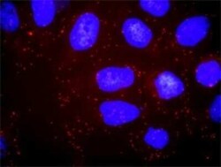 PI 3-Kinase p85 alpha Antibody (3A10), Novus Biologicals 0.1 mg | Buy Online | Novus Biologicals | Fisher Scientific