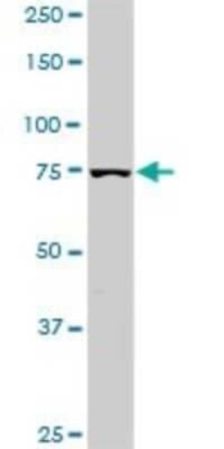 PI 3-Kinase p85 alpha Antibody (3C11), Novus Biologicals 0.1 mg | Buy Online | Novus Biologicals | Fisher Scientific