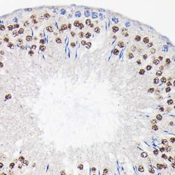 PI 3-Kinase p85 beta Rabbit anti-Human, Mouse, Rat, Clone: 6E2F5, Novus