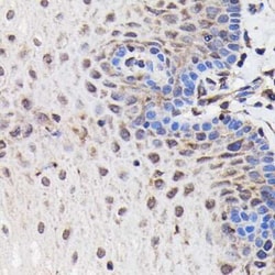 PI 3-Kinase p85 beta Rabbit anti-Human, Mouse, Rat, Clone: 6E2F5, Novus