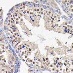 PI 3-Kinase p85 beta Rabbit anti-Human, Mouse, Rat, Clone: 6E2F5, Novus
