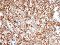 PI 3-Kinase p85 beta Mouse anti-Human, Clone: PIK3R2/292, Novus Biologicals