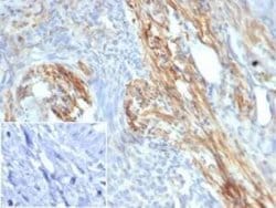 PI 3-Kinase p85 beta Mouse anti-Human, Clone: PIK3R2/292, Novus Biologicals