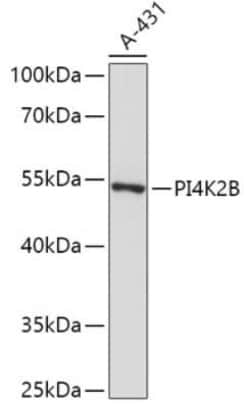 PI 4 Kinase type 2 beta Antibody - Azide and BSA Free, Novus Biologicals 0.02 mL | Buy Online | Novus Biologicals | Fisher Scientific